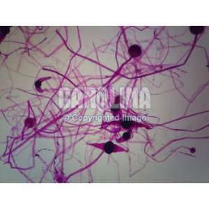 Rhizopus Conjugation, w.m. Microscope Slide  Industrial 