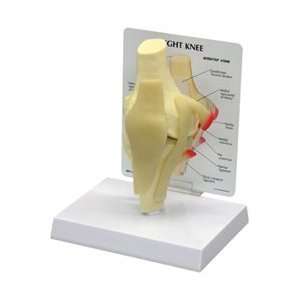 Basic Knee Joint Model w/ Anatomy Education Card  