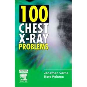   Ray Problems, 1e [Paperback] Jonathan Corne MA PhD FRCP Books